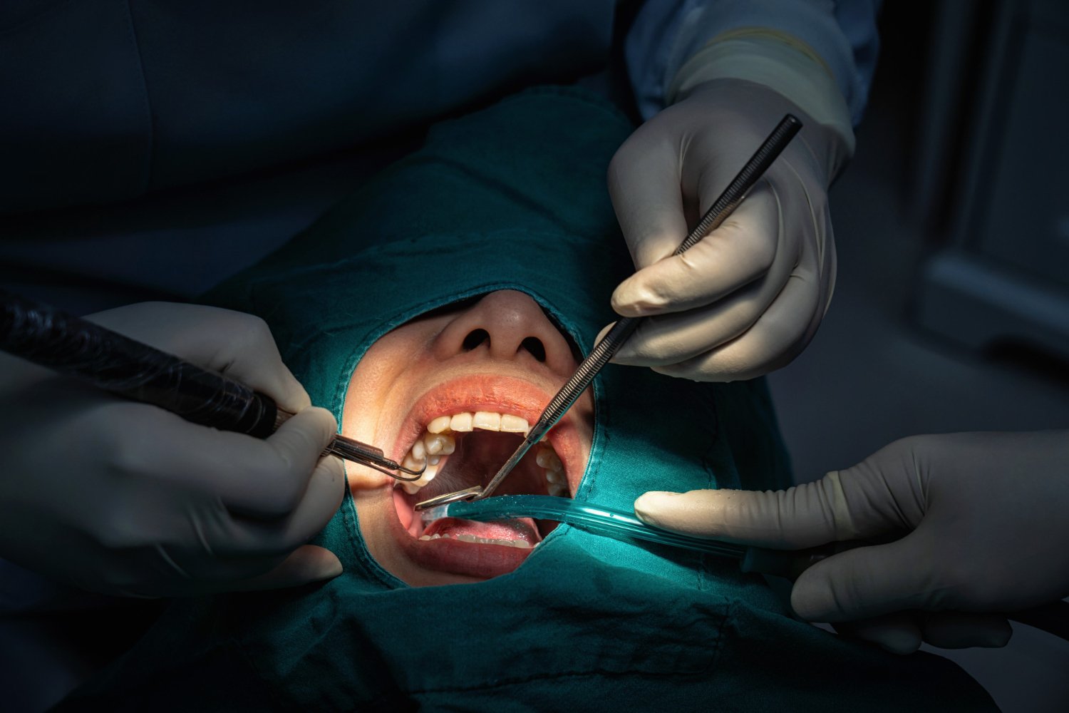 Oral Surgeries