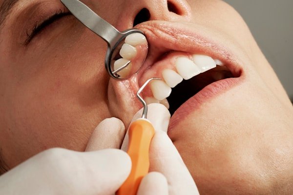 Root Canal Treatment